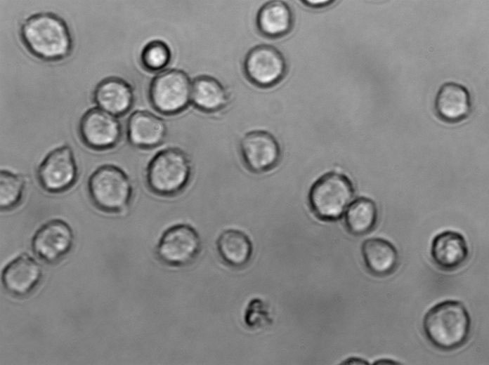 MUTZ-3 Cell|急性非淋巴白血病细胞