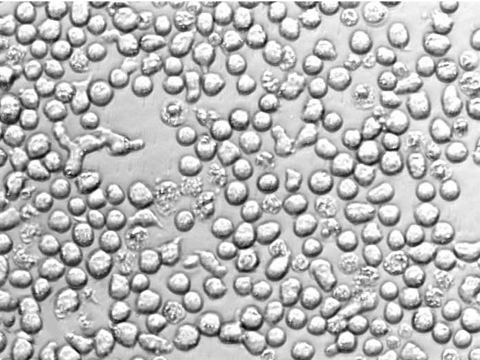 P116 Cell|人急性淋巴白血病细胞