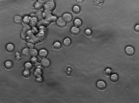 OCI-AML-3 Cell|人急性髓细胞性白血病细胞
