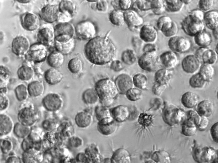 KM933 Cell|EB病毒转化的人B淋巴细胞