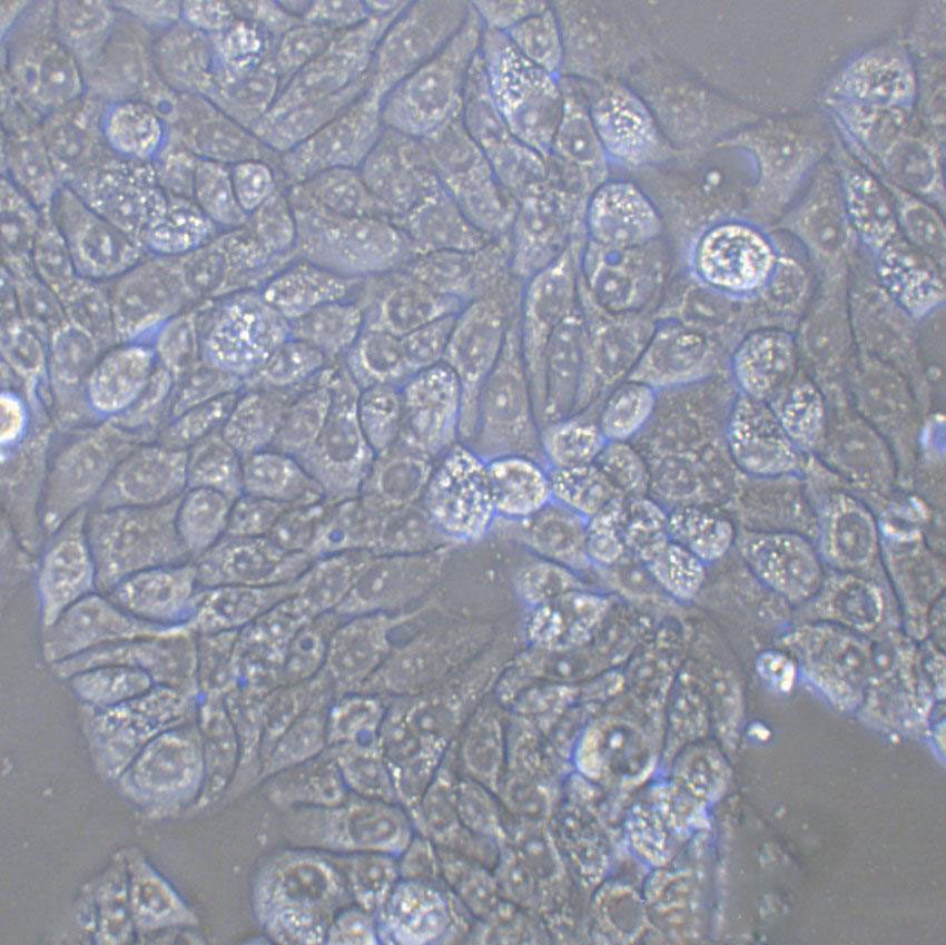 NCI-H226 Cell|人肺鳞癌细胞