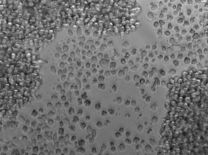 H9人T淋巴瘤复苏细胞(附STR鉴定报告)