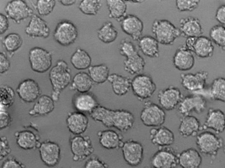 HH [Human lymphoma]人皮肤T淋巴细胞瘤复苏细胞(附STR鉴定报告)