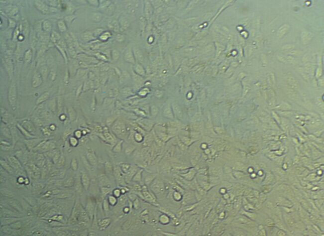 hMSC-BM Cells(赠送Str鉴定报告)|人间充质干细胞