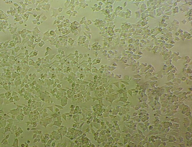 VCaP Cell|人前列腺癌细胞