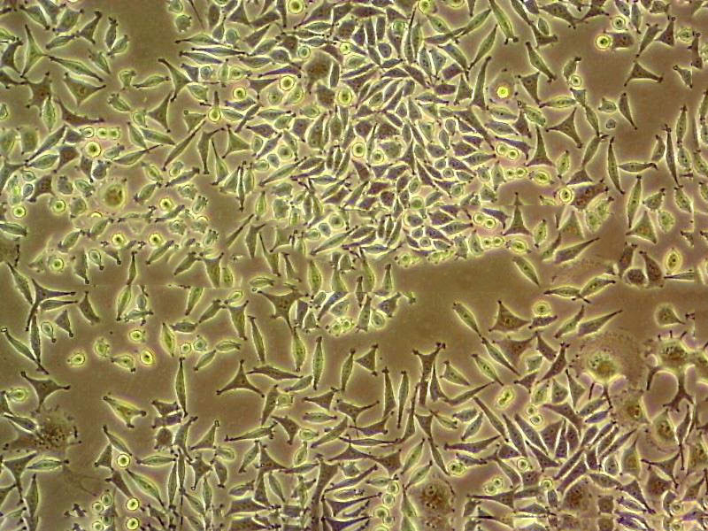 MDA-kb2 Cell|人正常乳腺细胞