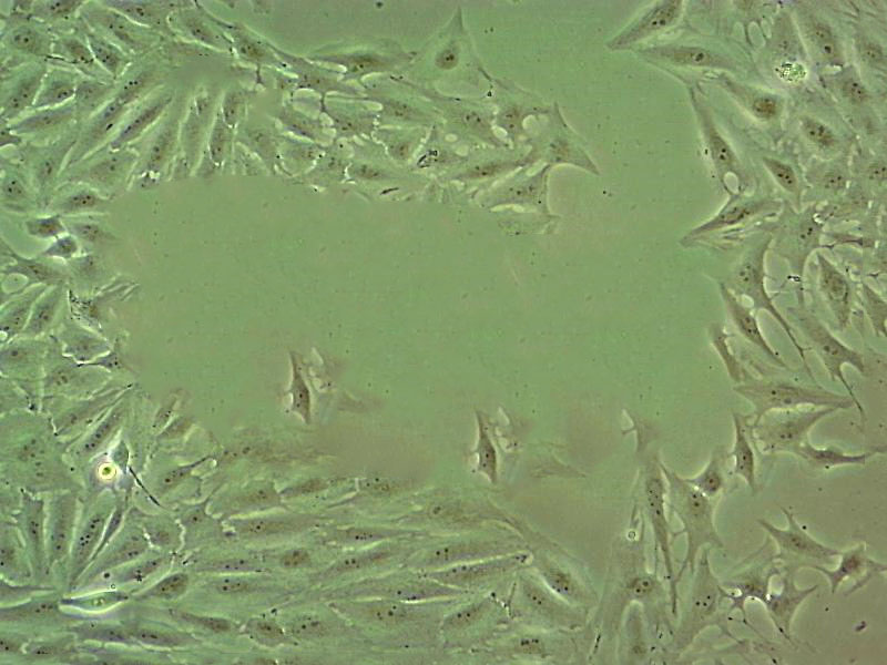 BeWo Cell|人胎盘绒膜癌细胞