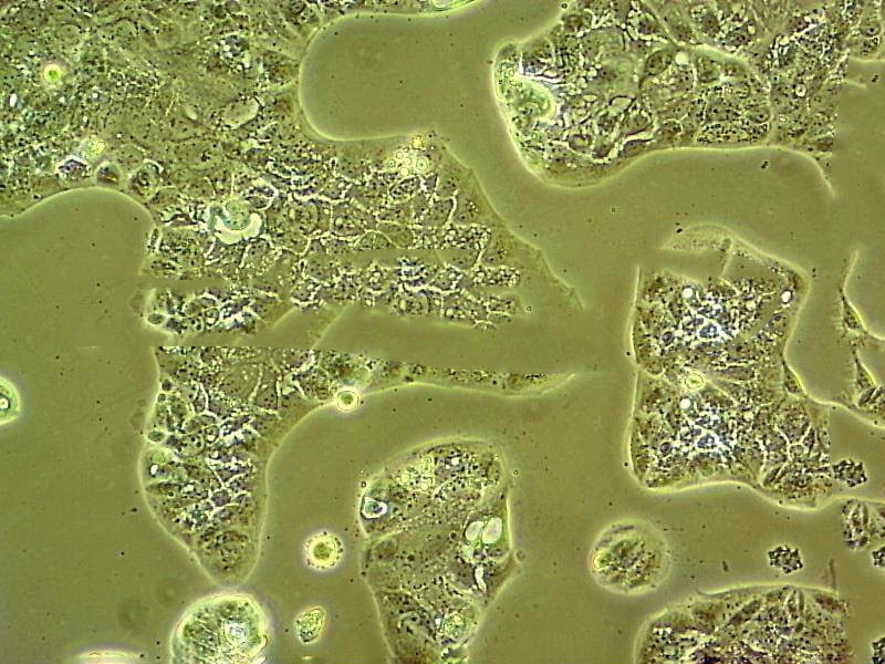 MKN1 Cell|人胃癌细胞