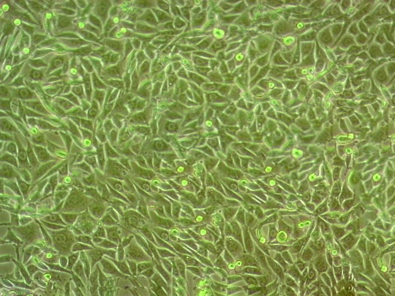 SCaBER Cell|人鳞状膀胱癌细胞