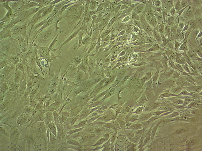 Caov-3 Cell|人卵巢癌细胞