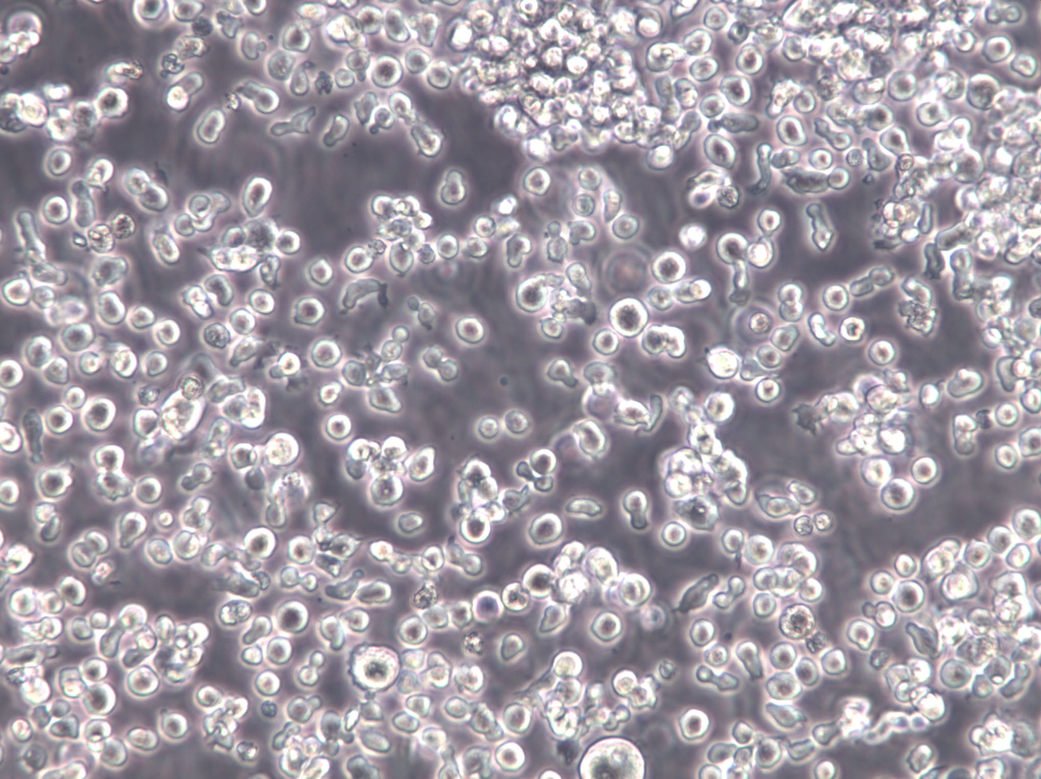 HH [Human lymphoma]:人皮肤T淋巴细胞瘤复苏细胞(提供STR鉴定图谱)