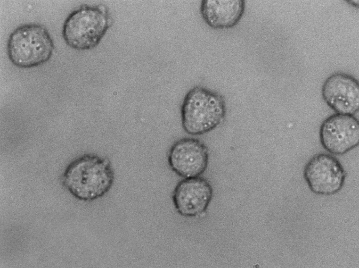 CCRF-CEM:人急性淋巴细胞白血病T淋巴复苏细胞(提供STR鉴定图谱)