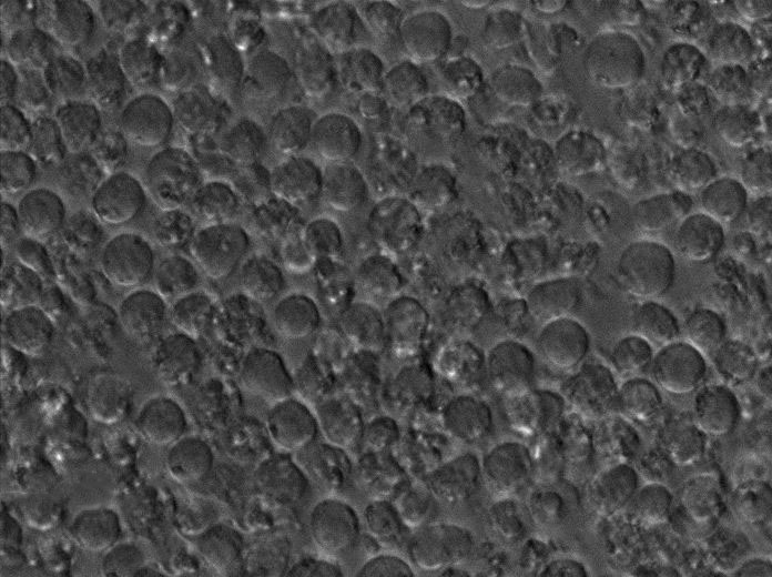 YT:人NK细胞白血病复苏细胞(提供STR鉴定图谱)