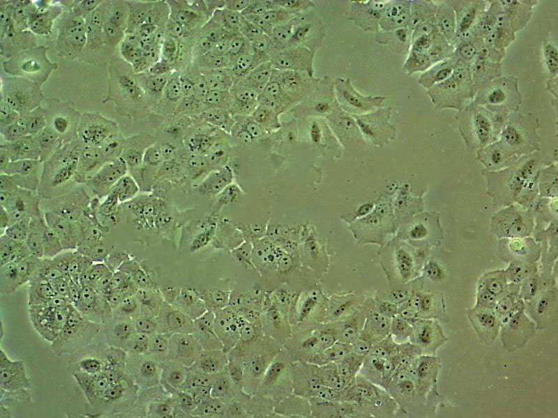 KNS-81 Cell|人神经胶质瘤细胞