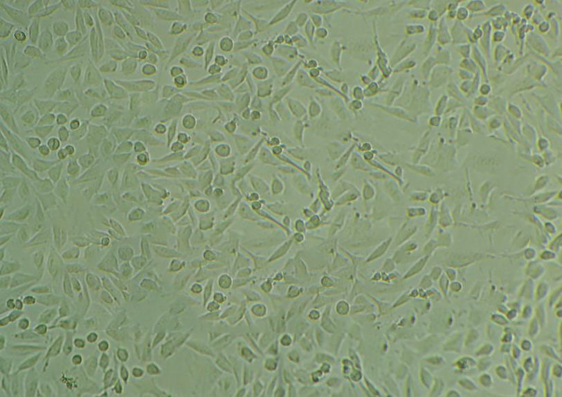 TE-11 Cell|人食管癌细胞