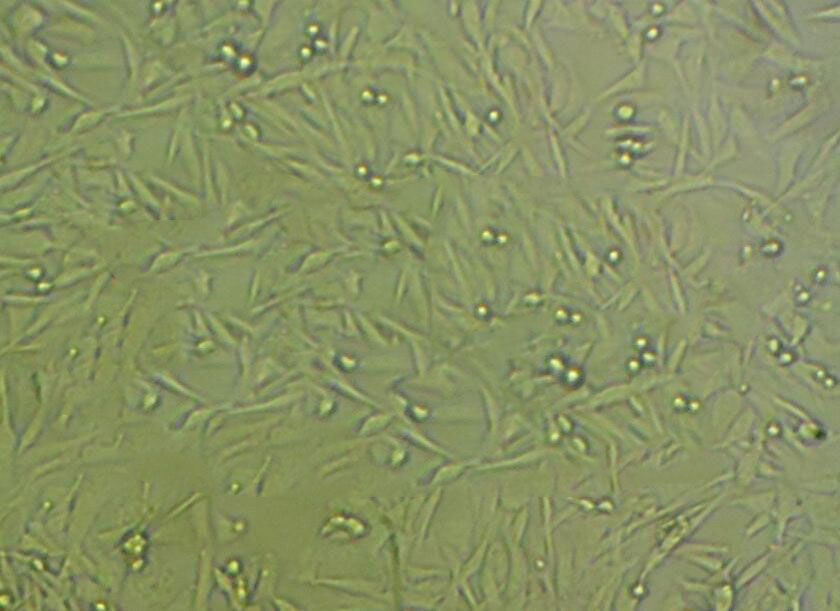 TE-6 Cell|人食管癌细胞