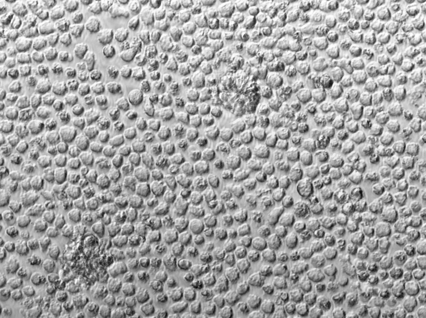 Pfeiffer Cell Lines:人弥漫性大细胞淋巴瘤B淋巴细胞(STR认证)