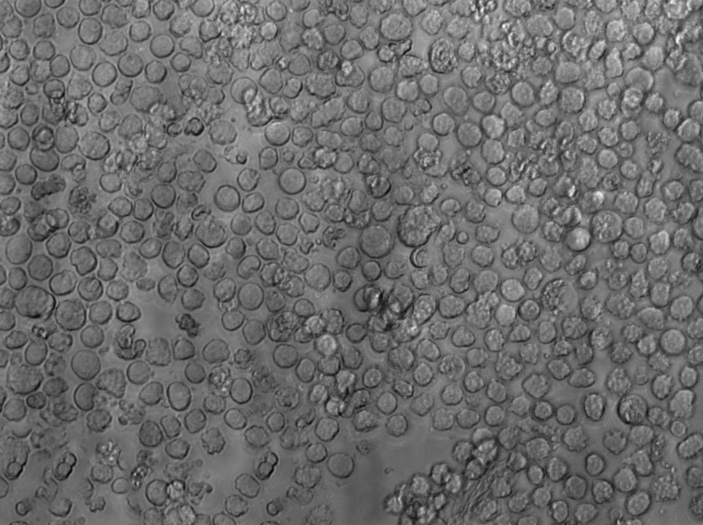 OCI-Ly10 Cell Lines:人弥漫大B细胞淋巴瘤细胞(STR认证)