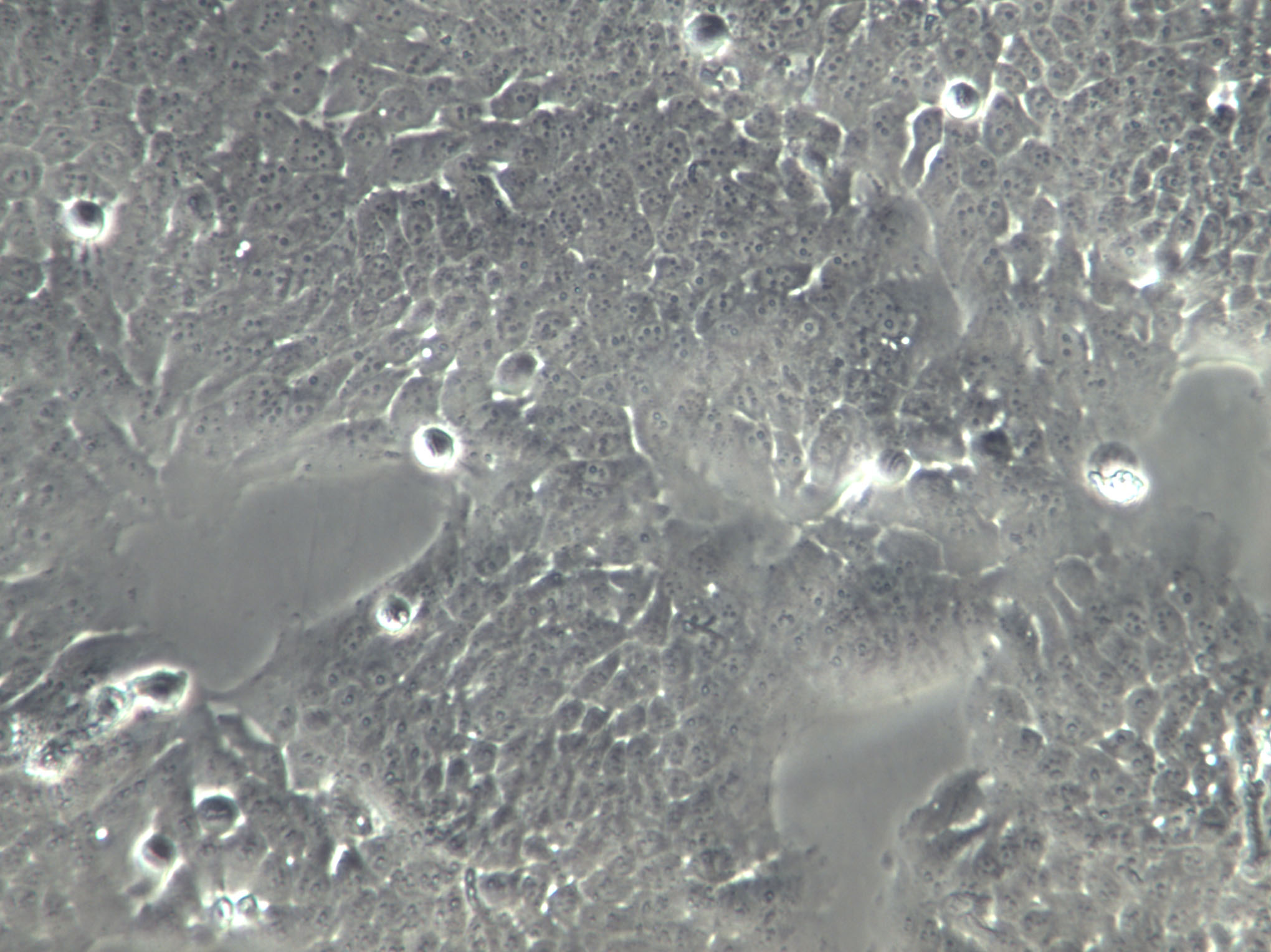 SCL-I Cell|人皮肤磷癌细胞