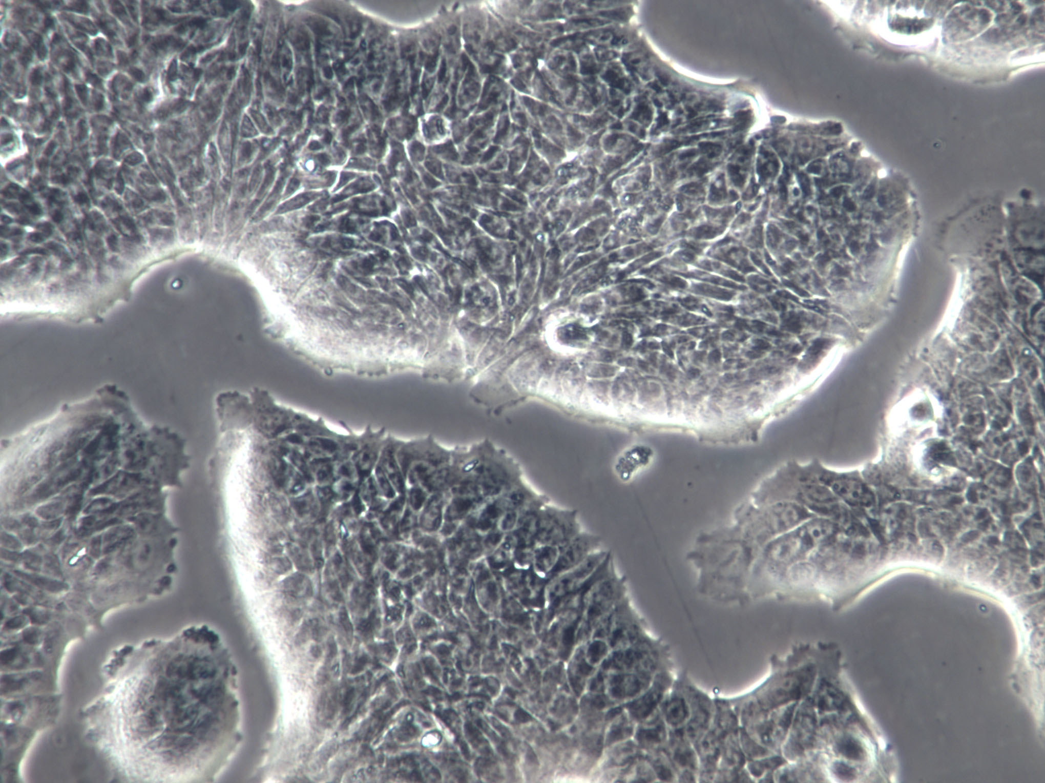 BEL-7405 Cell|人肝癌细胞