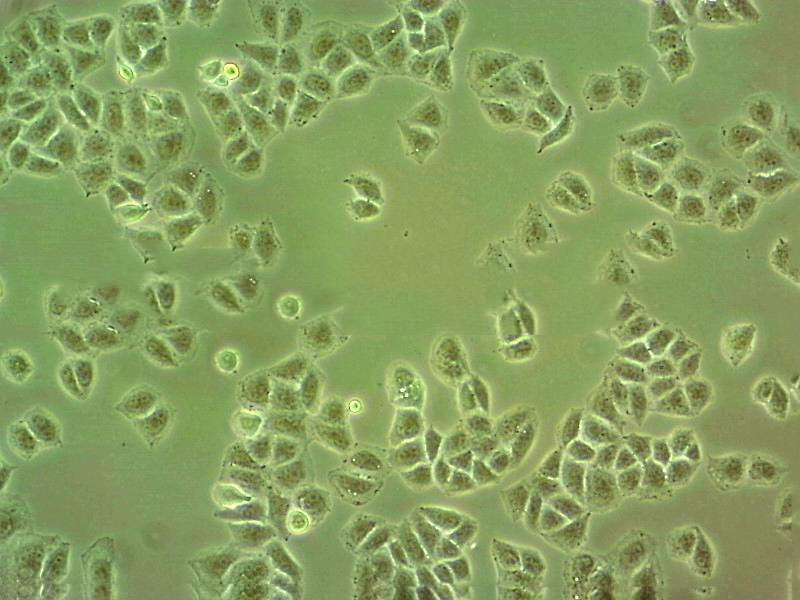 CCD-1095Sk Cell|人乳腺浸润性导管癌旁皮肤细胞
