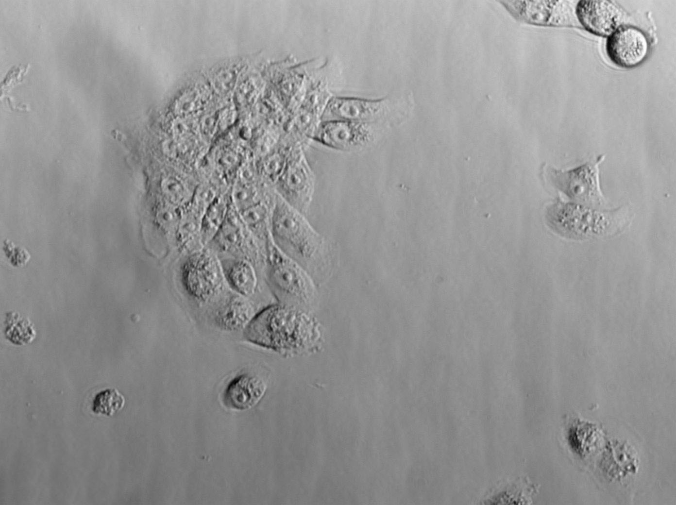 Hs 578Bst Cell|人正常乳腺细胞