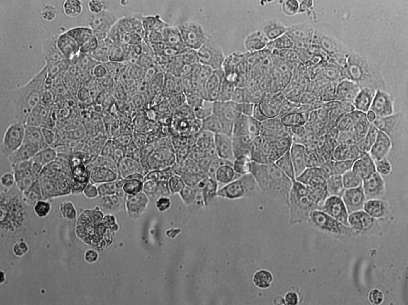 WiDr Cell|人结直肠癌细胞