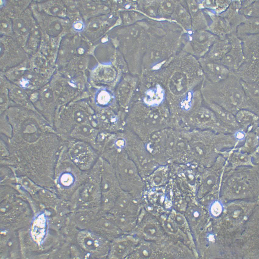 NCI-H1417 Cell|人小细胞肺癌细胞
