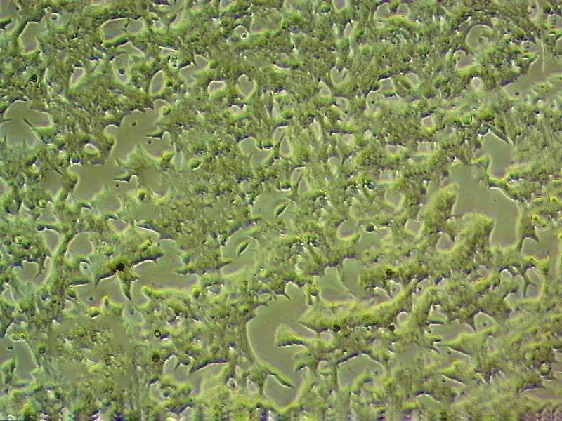 KYSE-180 Cell|人食管鳞癌细胞