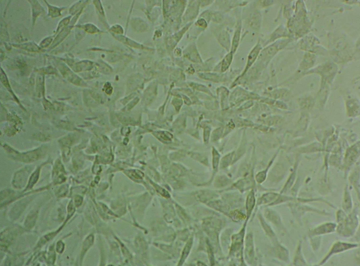 HCCLM6 Cell|人肝癌细胞