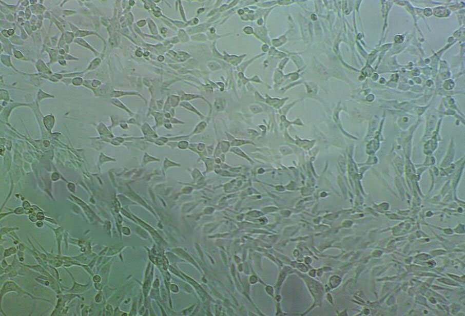 67NR Cell|小鼠乳腺癌细胞