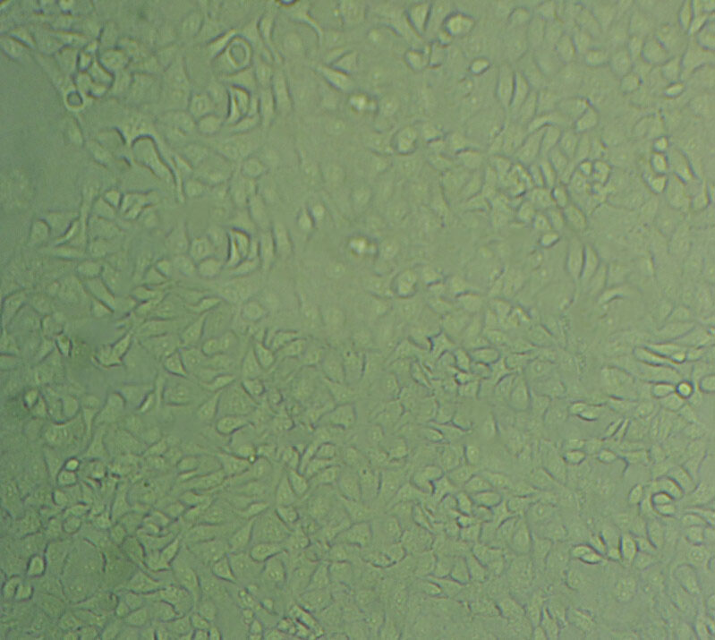 SK-RC-52 Cell|人肾癌细胞