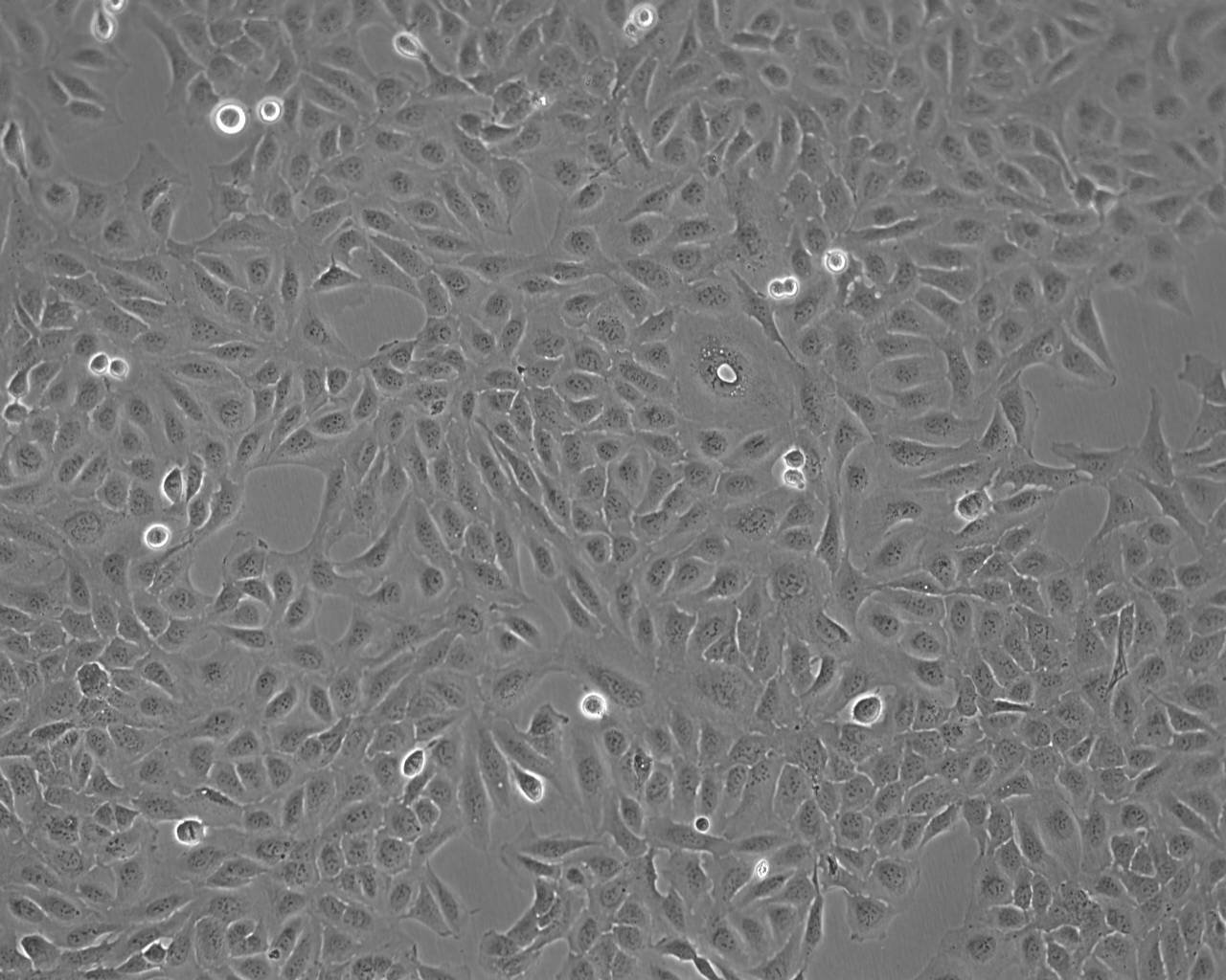 SK-N-BE(2)-C Cell|人神经母细胞瘤细胞