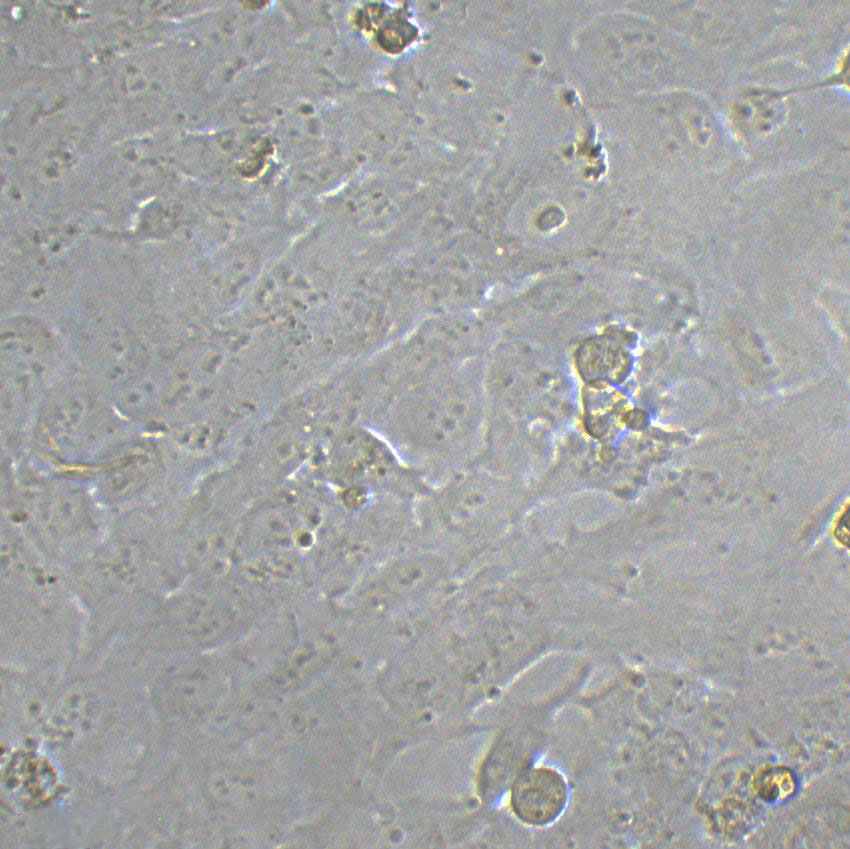 SW1088 Cell|人脑星形胶质瘤细胞