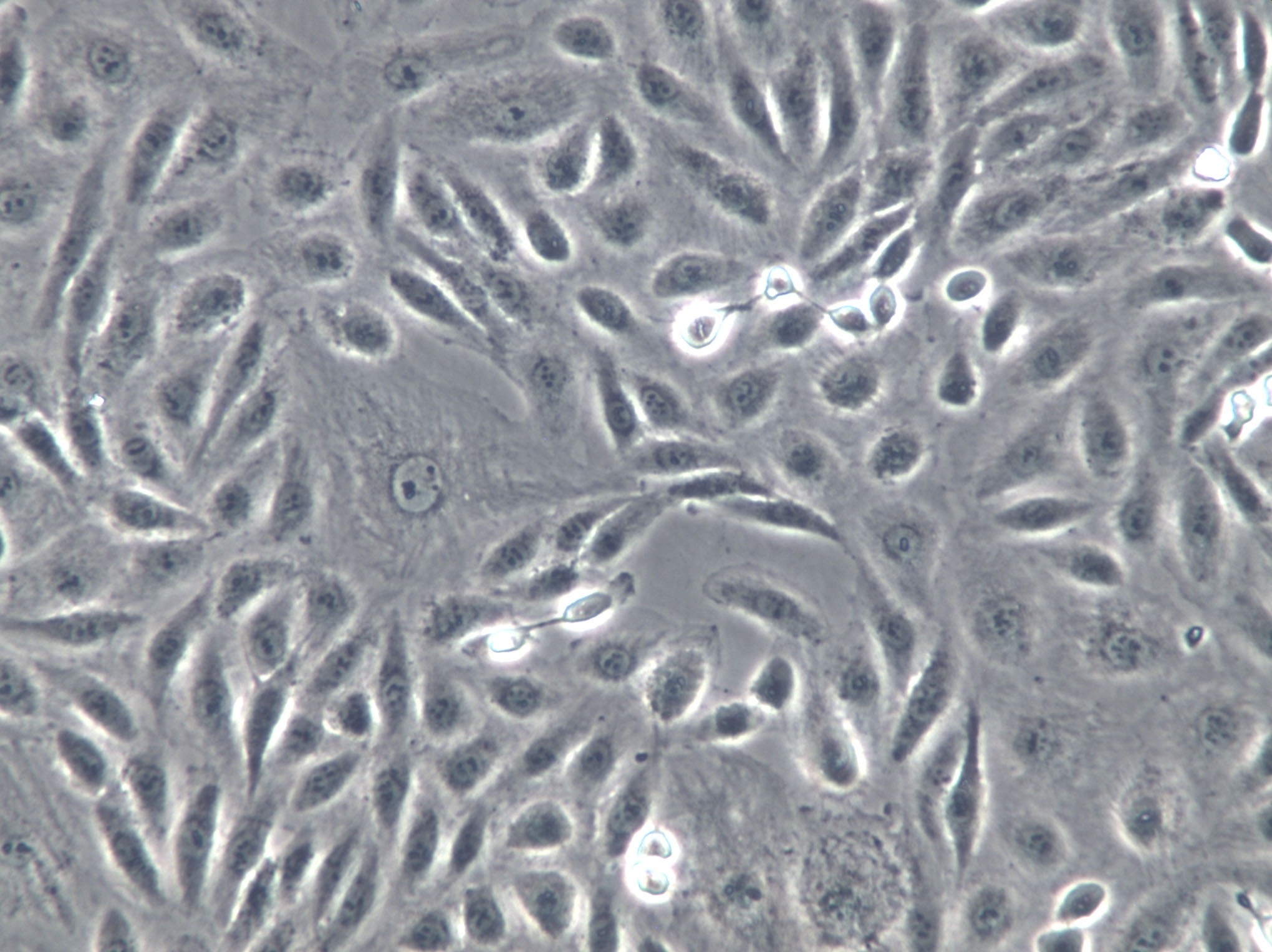 Ca759 Cell|小鼠乳腺癌细胞