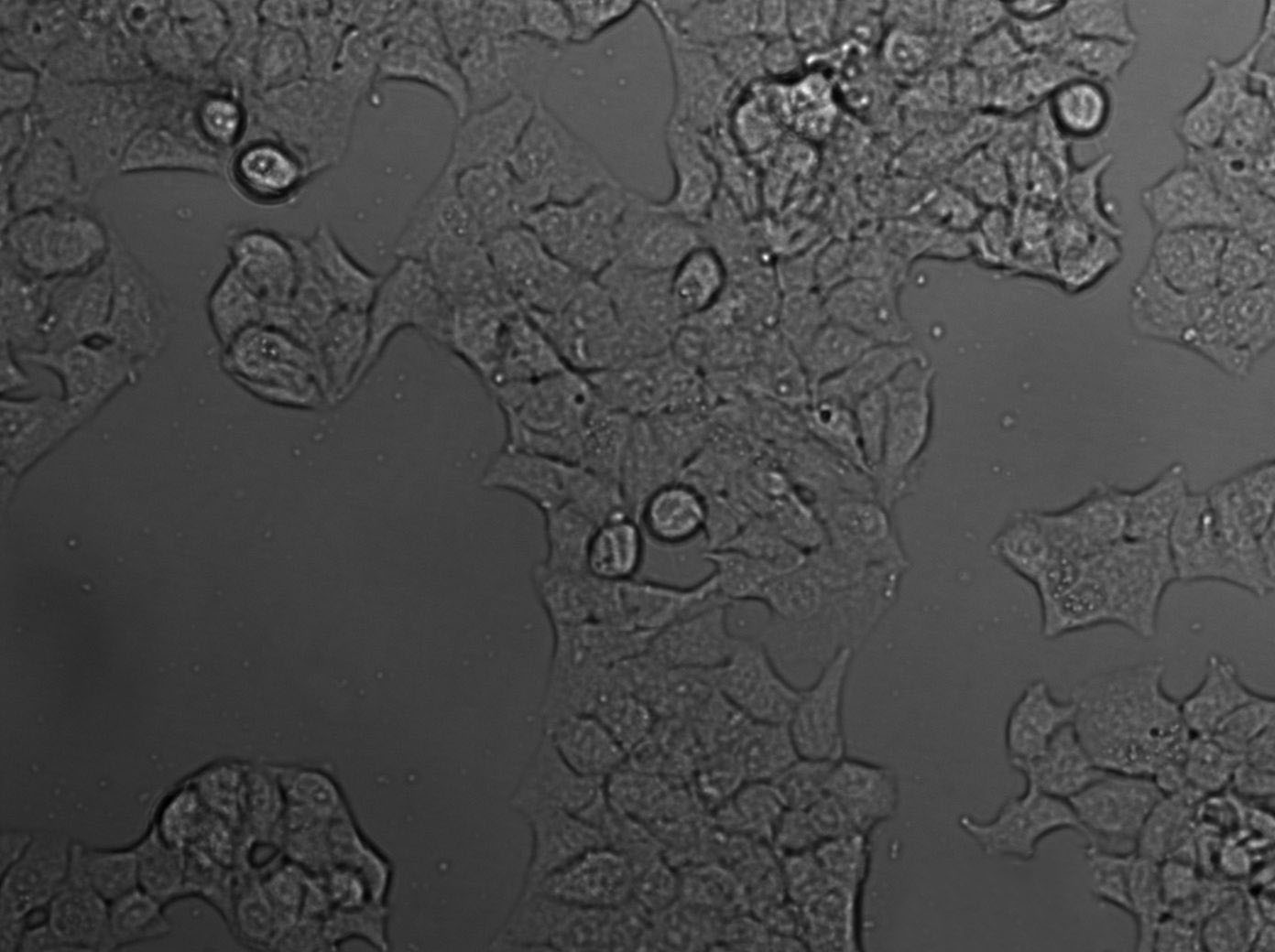 FET Cell|人结肠癌细胞