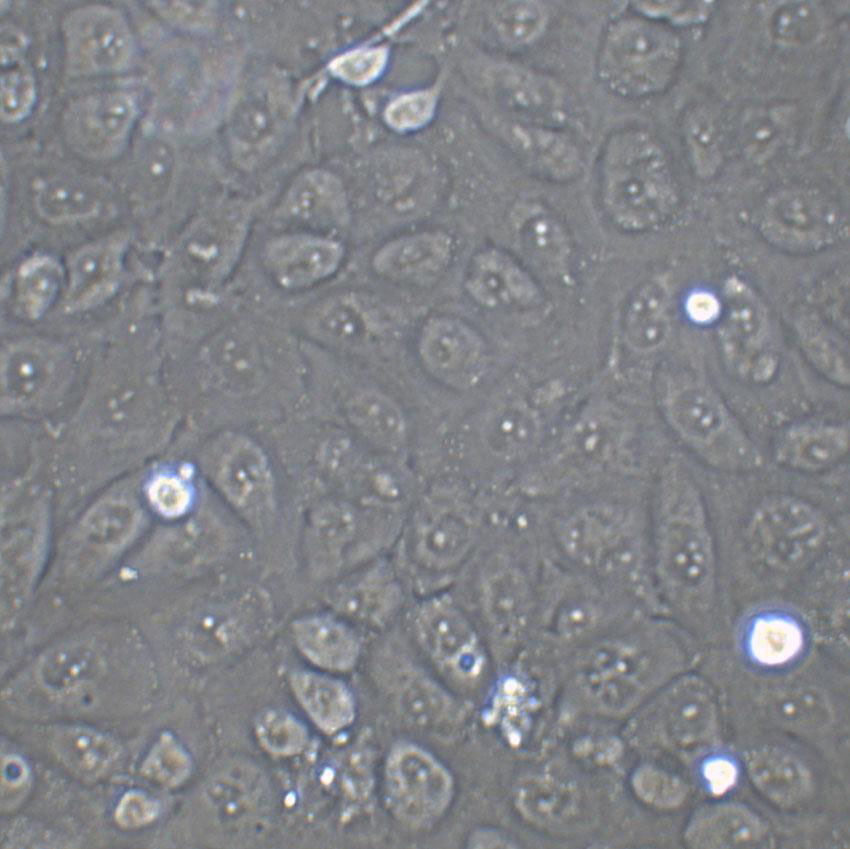 CMT167 Cell|小鼠肺癌细胞