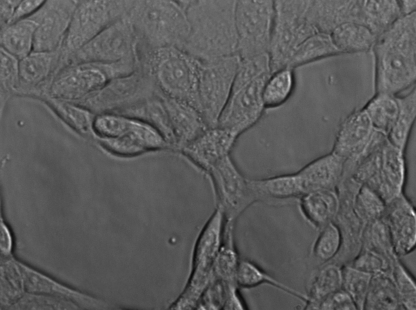 AE1201 Cell|人肺转化细胞