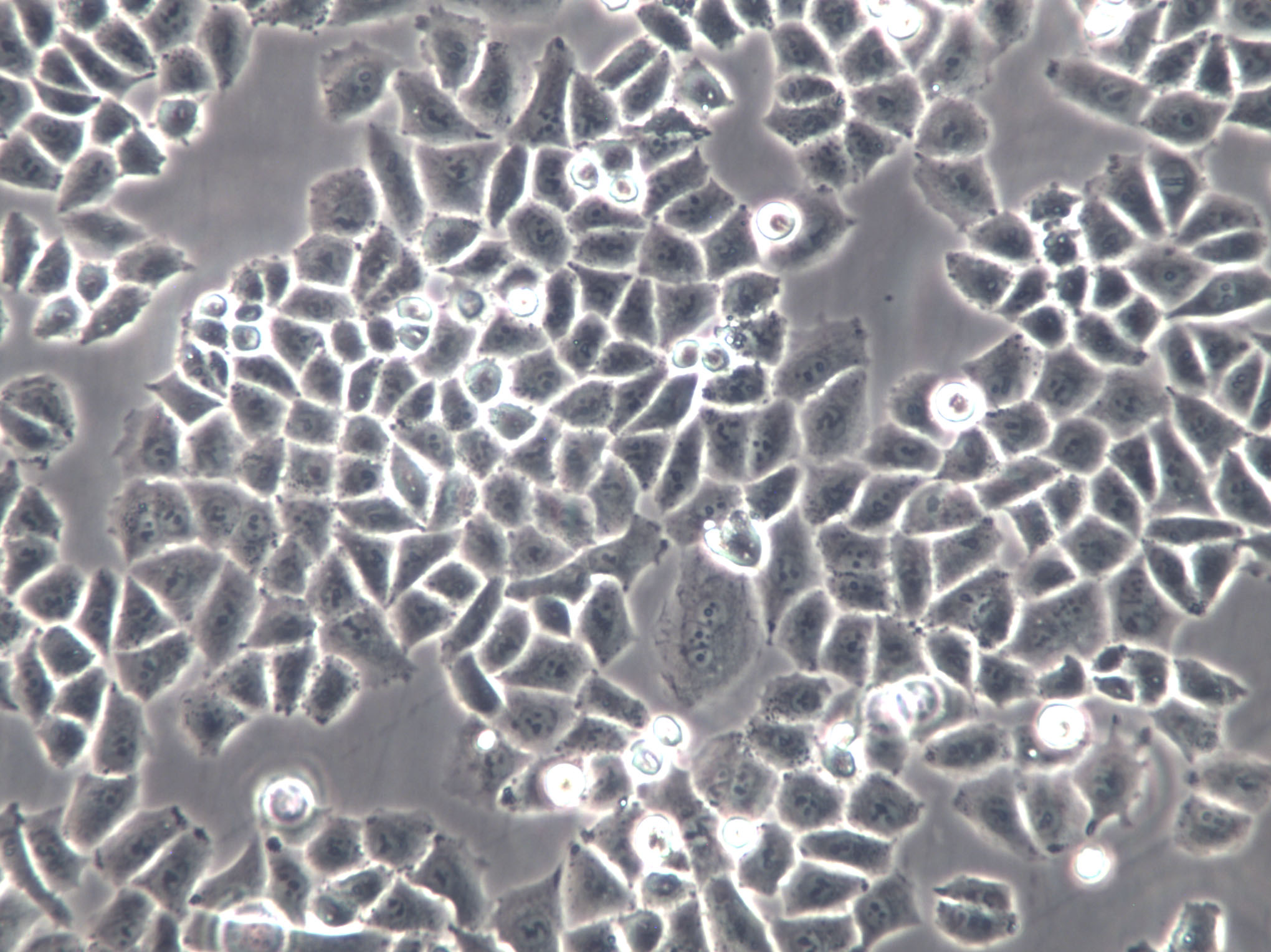 Anglne Cell|人卵巢癌细胞