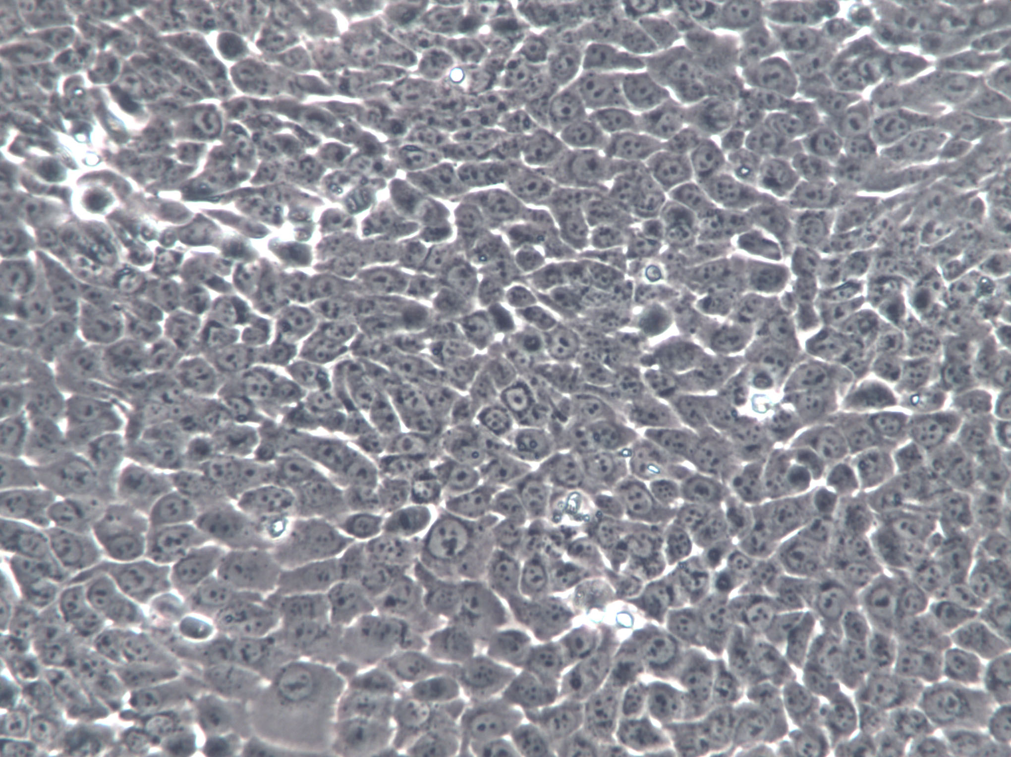 CNE-1 Cell|人鼻咽癌细胞