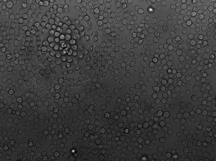 酵母氨基酸缺陷型合成液体培养基基础[组氨酸/亮氨酸/色氨酸/尿嘧啶缺陷]