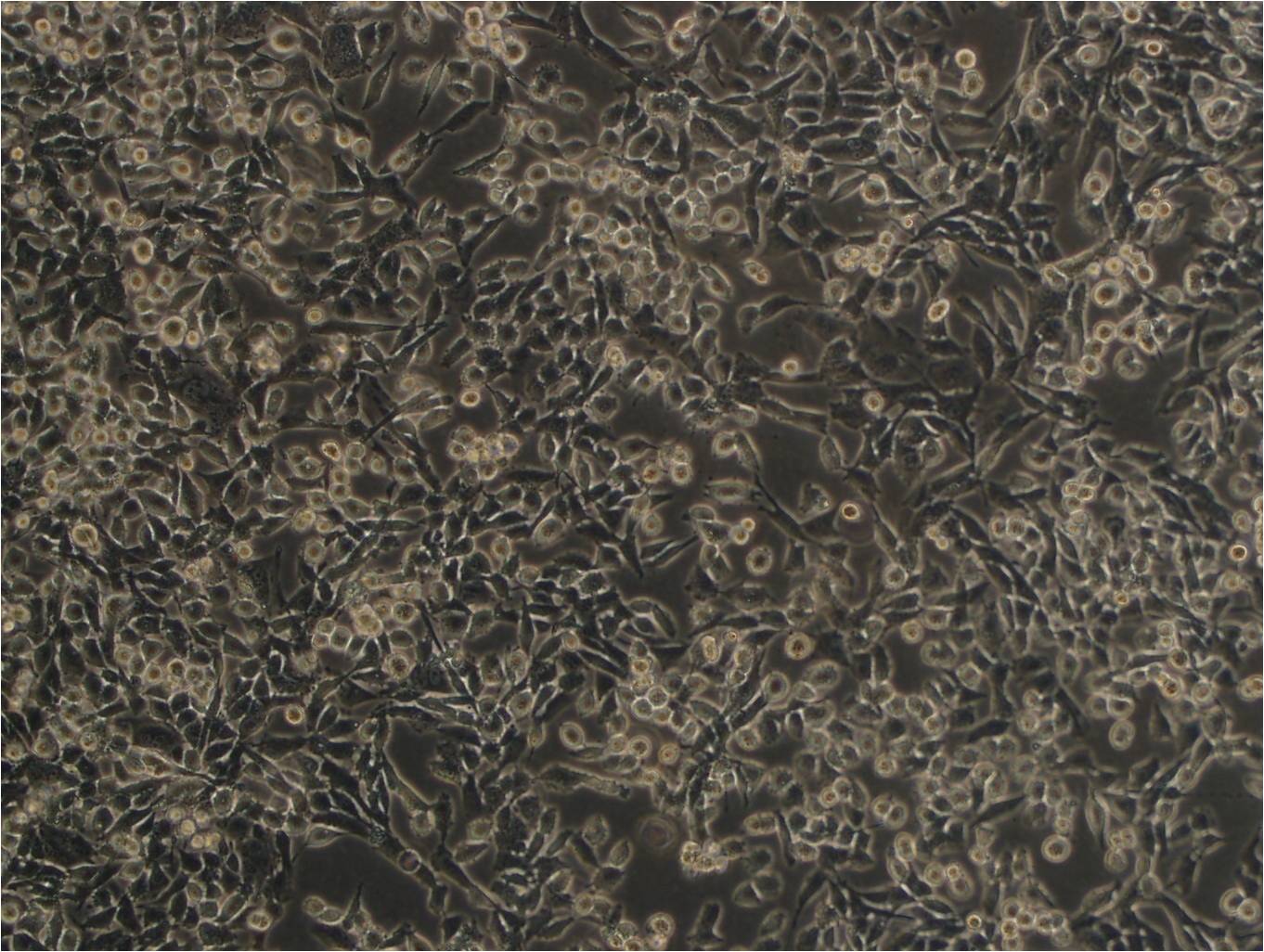 SLMT-1 Cell|人食管鳞癌细胞