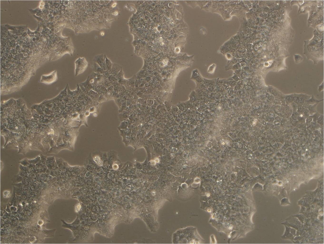 A-549 Cell|人肺癌细胞