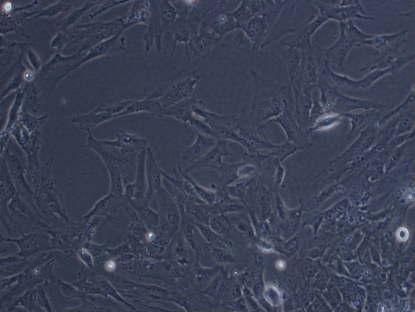 NW38 Cell|人黑色素瘤细胞