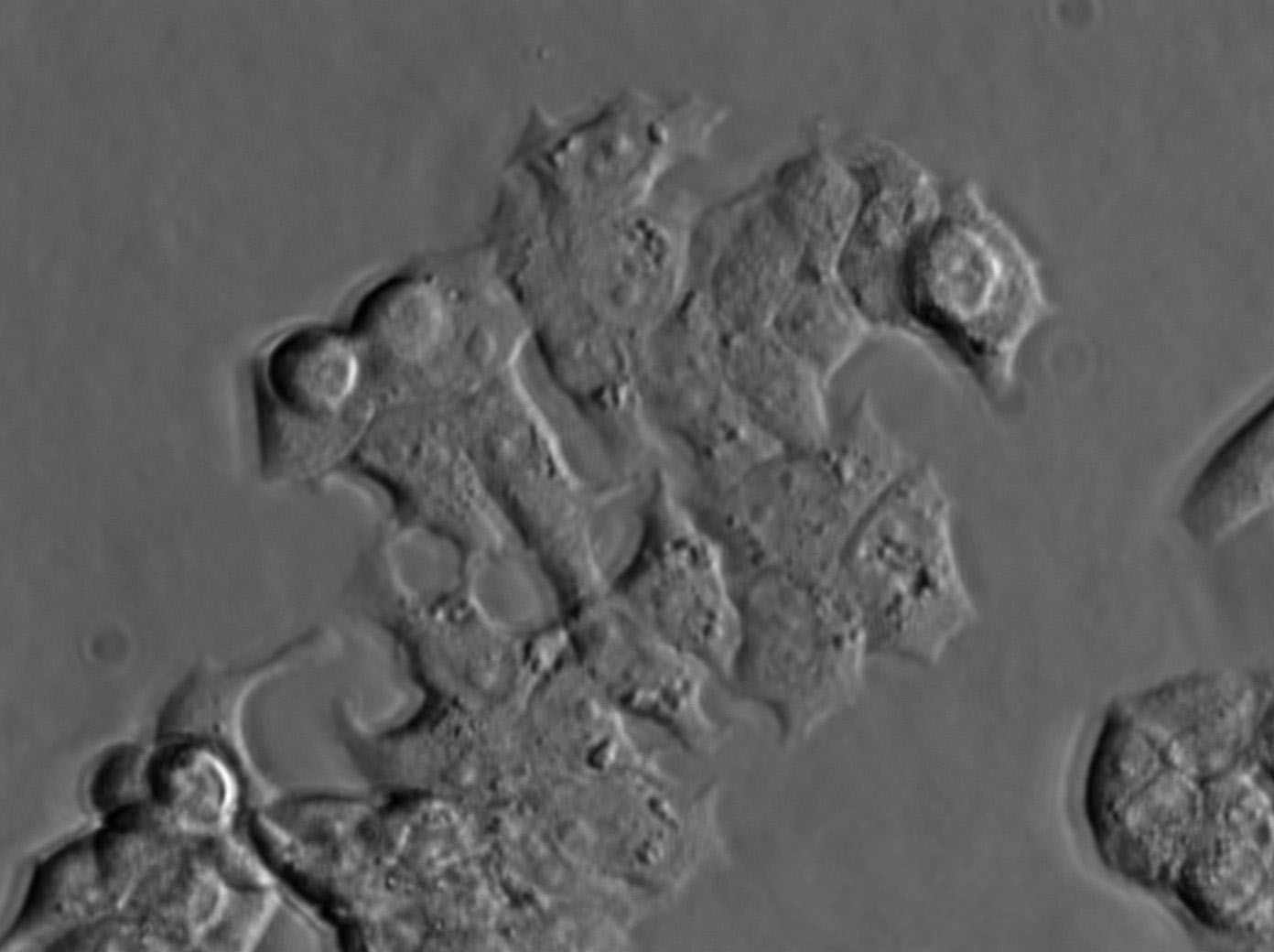 SNU-601 Cell|人胃癌细胞