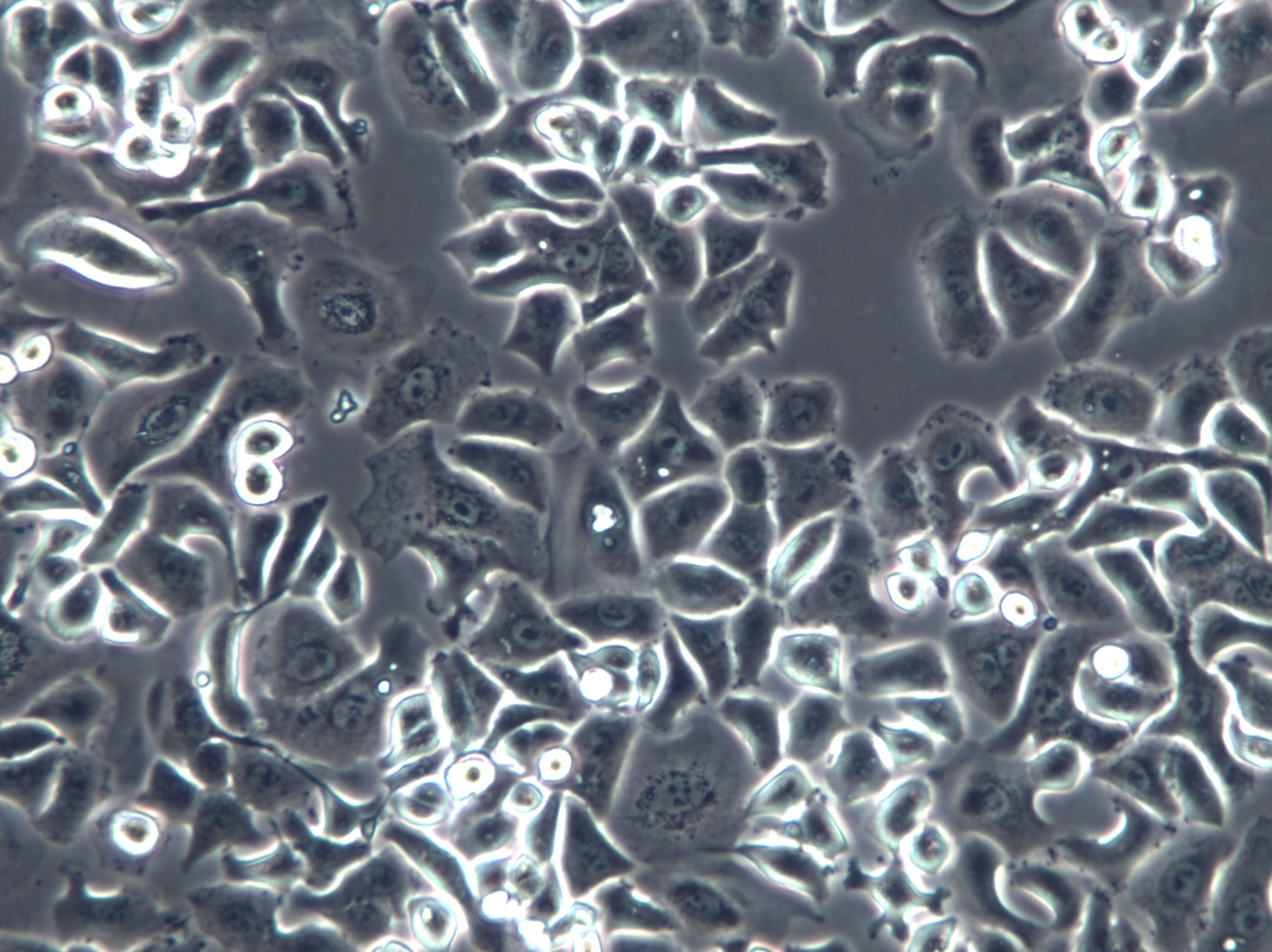NCI-H2198 Cell|人肺癌细胞