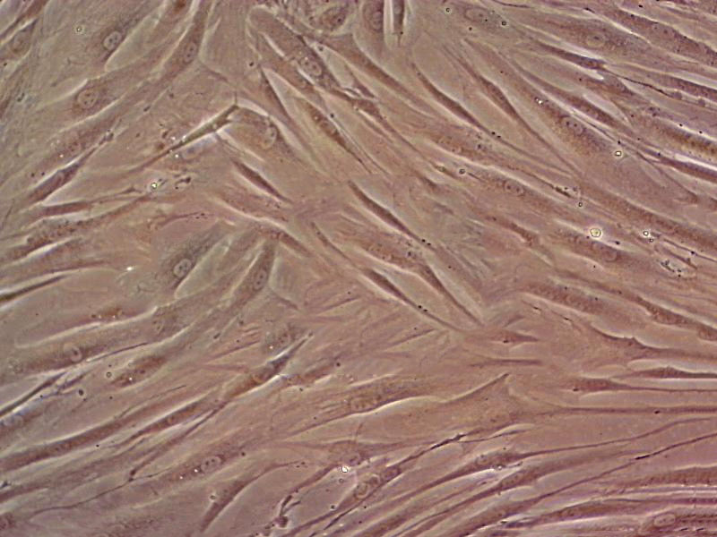 MRC-5 Cell|人胚肺成纤维细胞