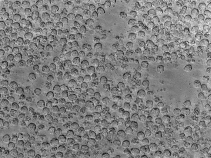 伊红美蓝琼脂培养基基础[不含乳糖]