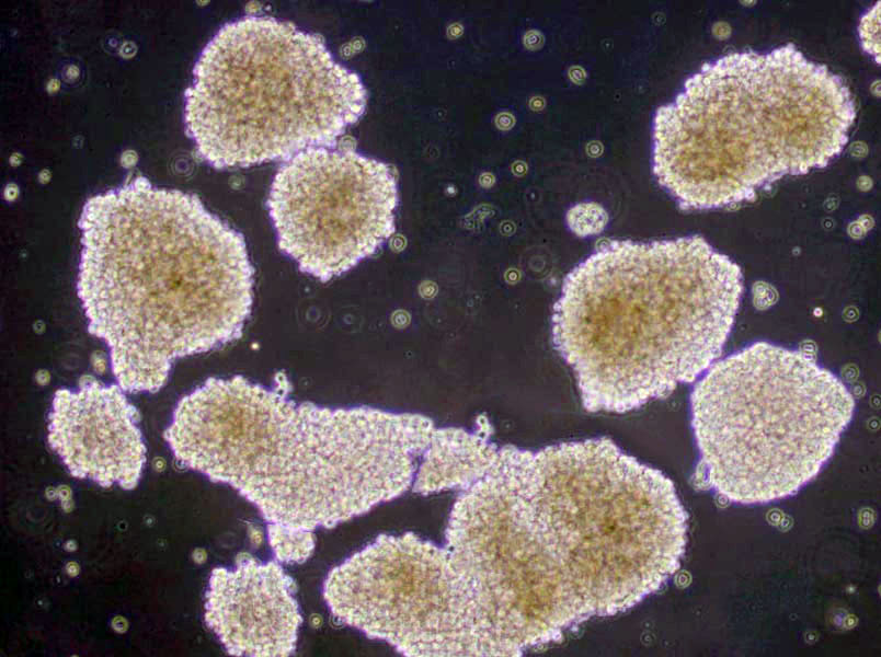 亚碲酸钾血琼脂培养基基础