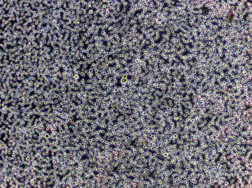 脱脂乳培养基基础